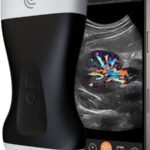Portable-Ultrasound-Scanner