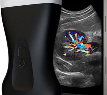 Portable-Ultrasound-Scanner