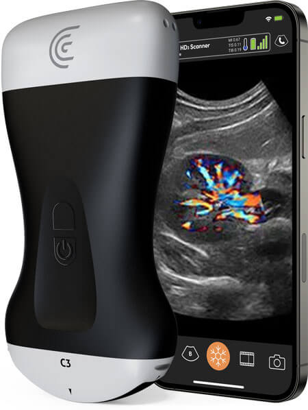 Portable-Ultrasound-Scanner